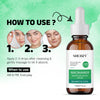 Socozy 10% Naicinamide Face Serum for Dark Spot| Blamish Blancing and Clean - 30ml
