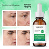 Socozy 10% Naicinamide Face Serum for Dark Spot| Blamish Blancing and Clean - 30ml