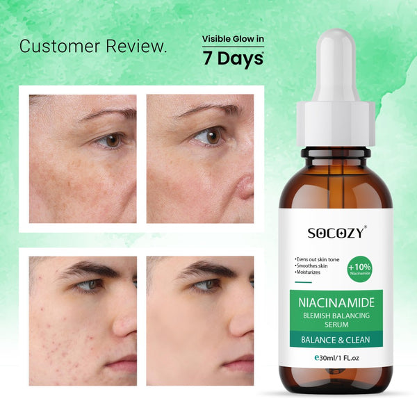 Socozy 10% Naicinamide Face Serum for Dark Spot| Blamish Blancing and Clean - 30ml