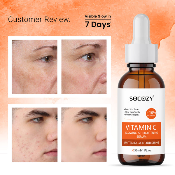 Socozy 10% vitamin c face serum for oliy skin|men & women|skin brightening.