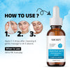 Socozy 2% Salicylic Acid Face Serum for Acne, Blackheads & Open Pores - 30ml